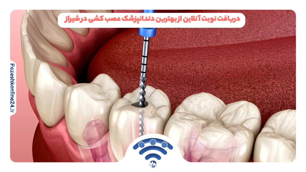 دریافت نوبت آنلاین از بهترین دندانپزشک عصب کشی در شیراز