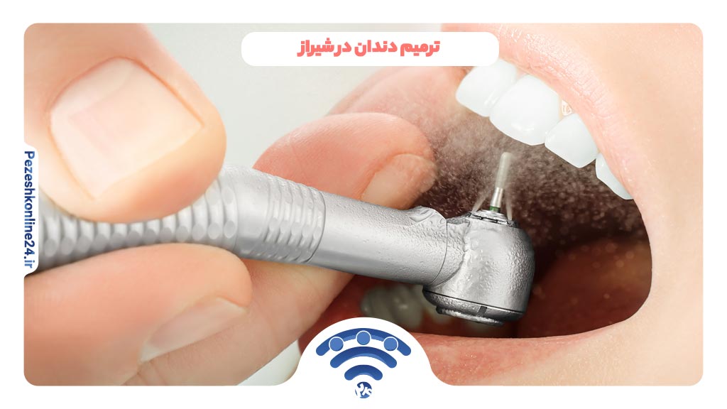 ترمیم دندان در شیراز | بهترین دکتر پر کردن دندان شیراز