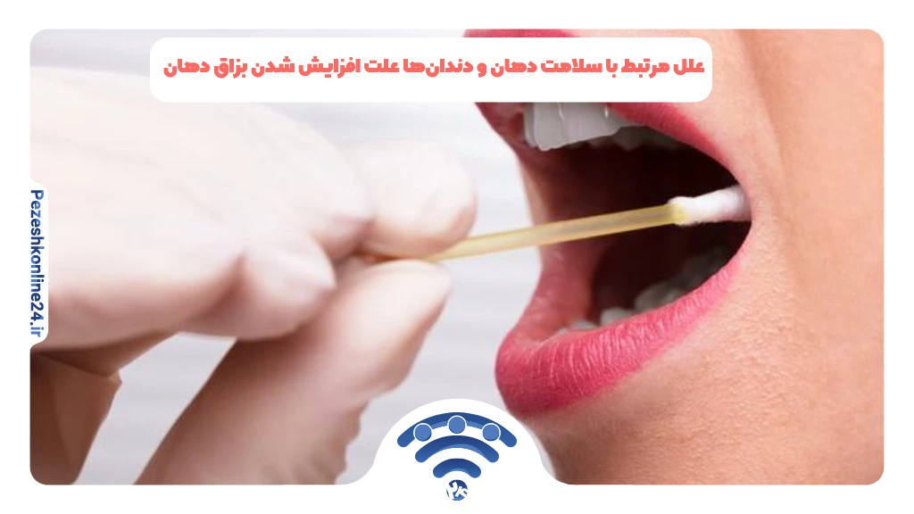 علل مرتبط با سلامت دهان و دندان‌ها علت افزایش شدن بزاق دهان