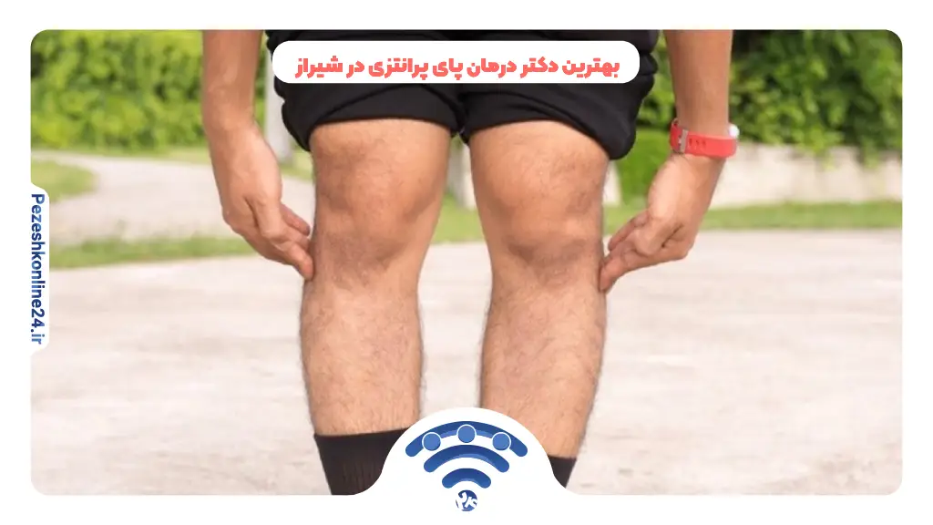 بهترین دکتر درمان پای پرانتزی در شیراز ❤️