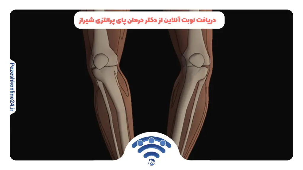 دریافت نوبت آنلاین از دکتر درمان پای پرانتزی شیراز