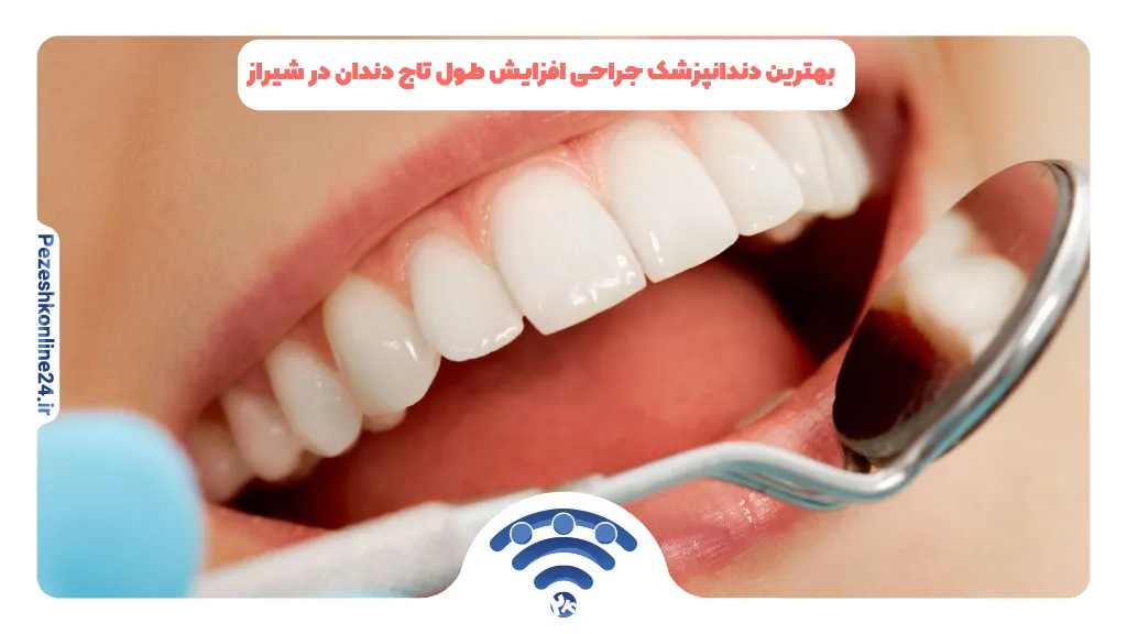 بهترین دندانپزشک جراحی افزایش طول تاج دندان در شیراز ❤️