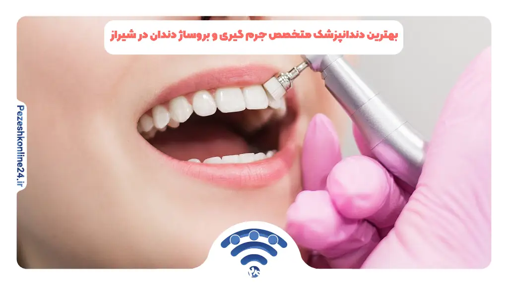 بهترین دندانپزشک متخصص جرم گیری و بروساژ دندان در شیراز