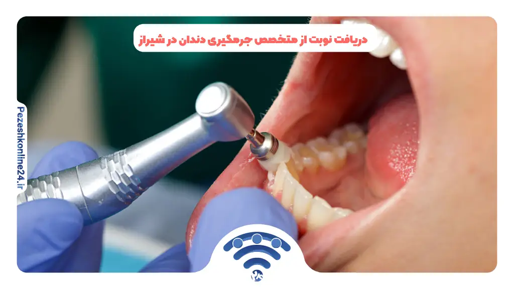 دریافت نوبت از متخصص جرمگیری دندان در شیراز