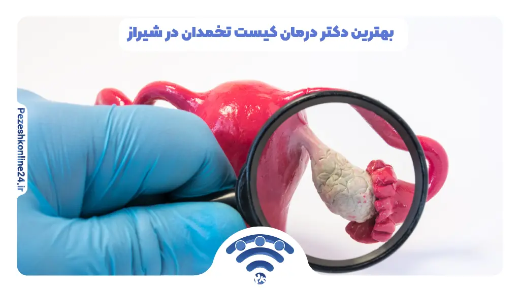 درمان کیست تخمدان در شیراز