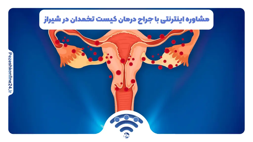 مشاوره اینترنتی با جراح درمان کیست تخمدان در شیراز