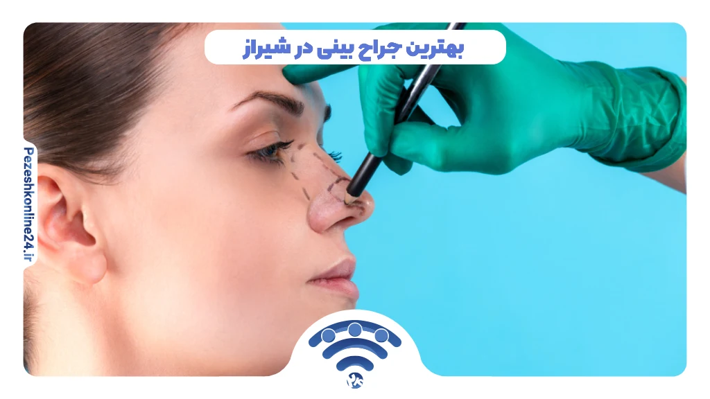 بهترین جراح بینی در شیراز | نمونه عمل جراحی بینی ❤️