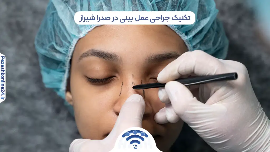 بهترین دکتر متخصص جراحی بینی در صدرا شیراز