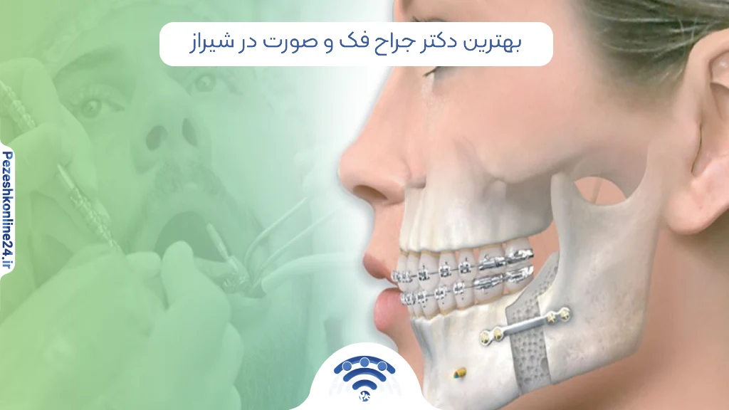 ۷ بهترین دکتر جراح فک و صورت در شیراز