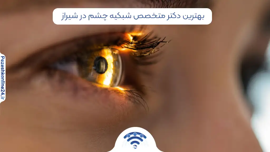 متخصص شبکیه چشم در شیراز