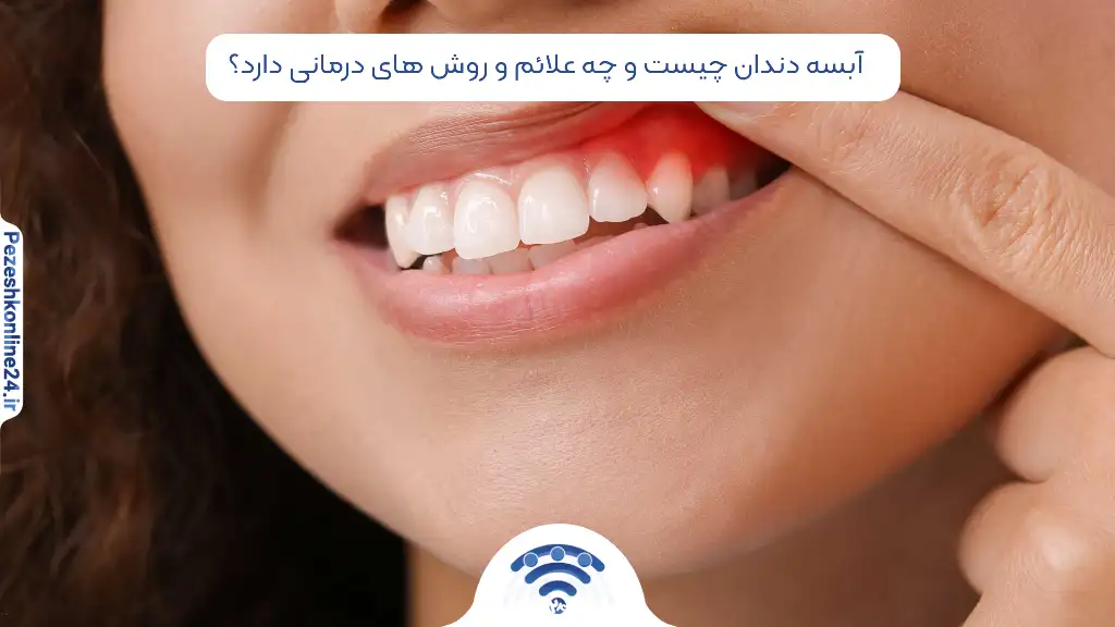 آبسه دندان چیست و چه علائم و روش های درمانی دارد؟