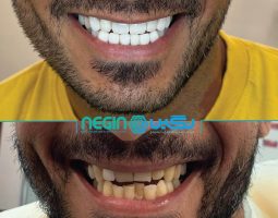 کلینیک دندانپزشکی و دهان پزشکی نگین