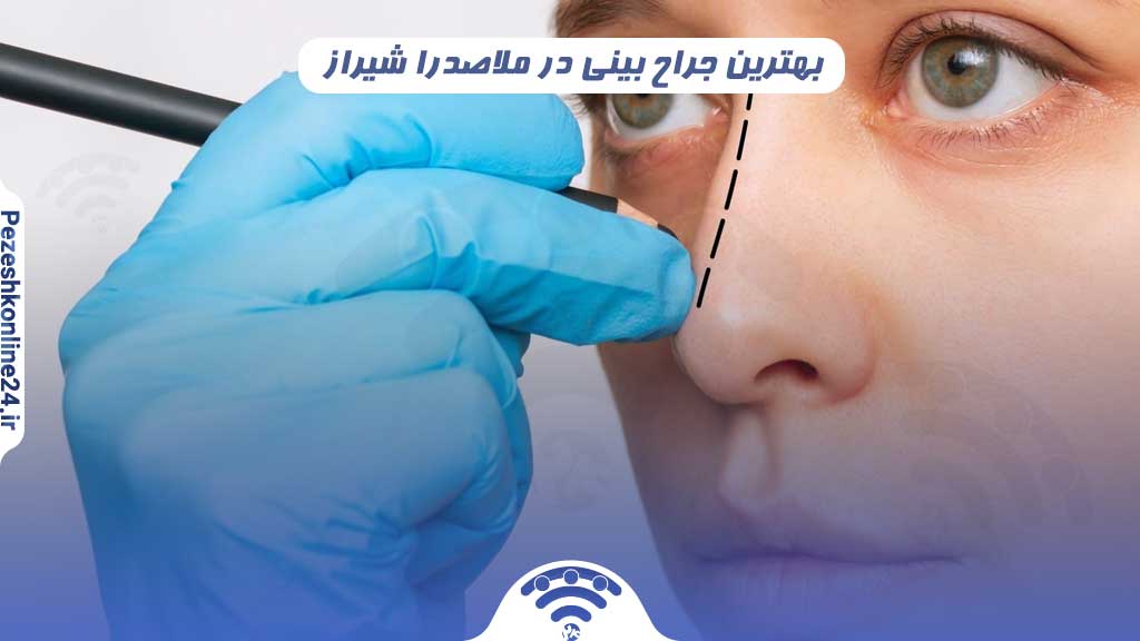 جراح بینی در ملاصدرا شیراز