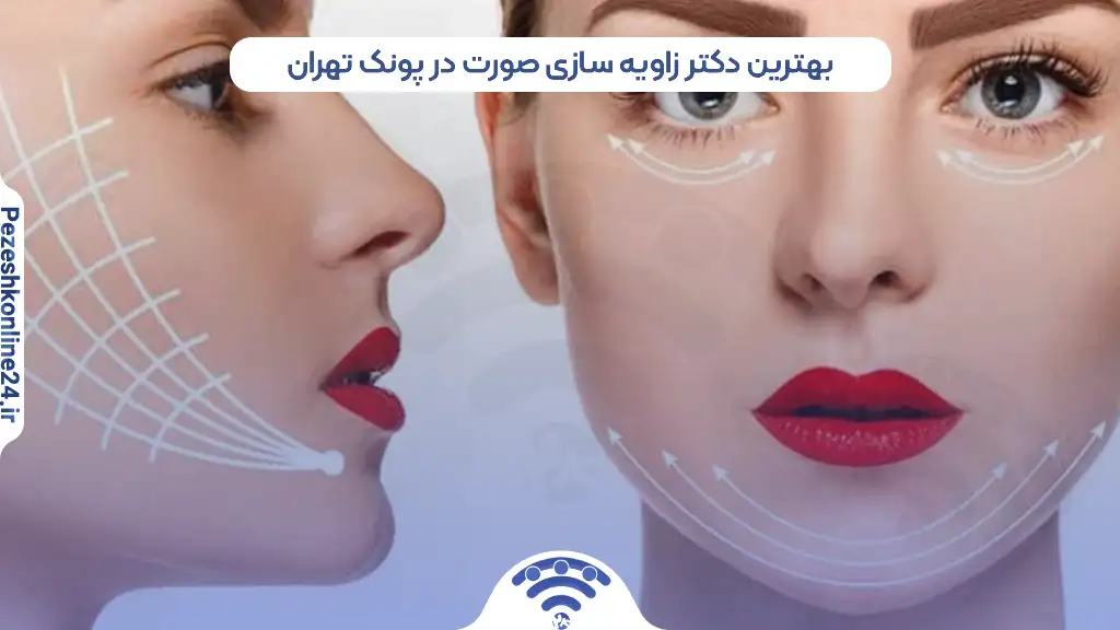 بهترین دکتر زاویه سازی صورت در پونک تهران