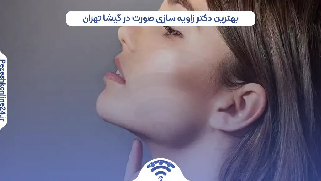 بهترین دکتر زاویه سازی صورت در گیشا تهران