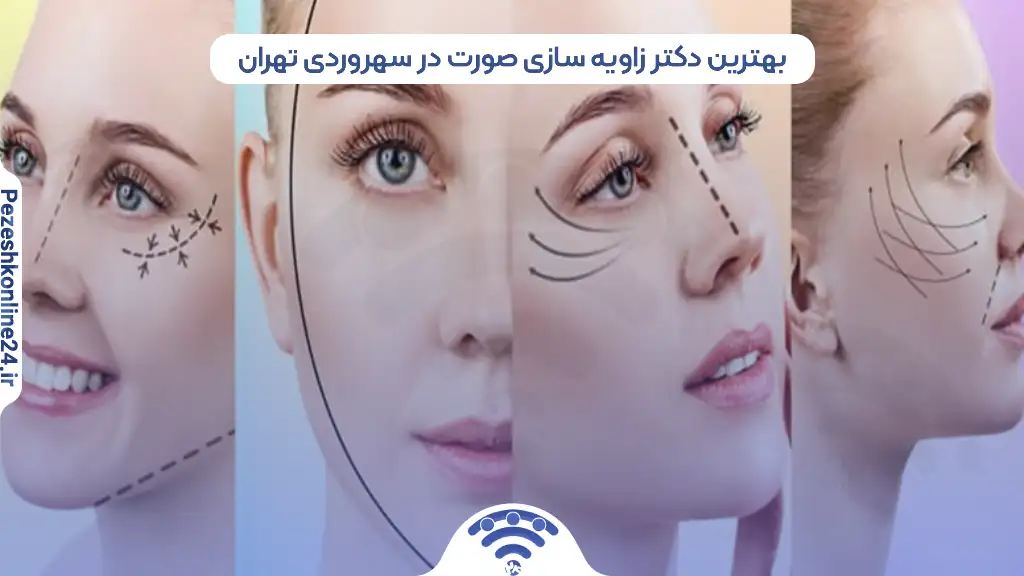 بهترین دکتر زاویه سازی صورت در سهروردی تهران