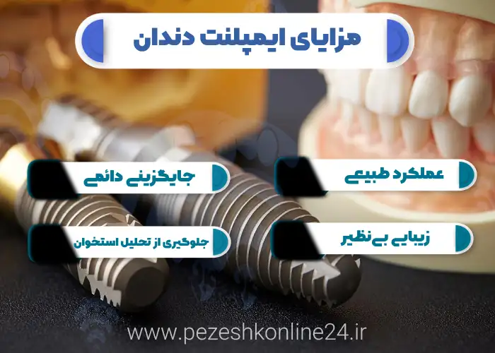 کاشت دندان در صدرا شیراز