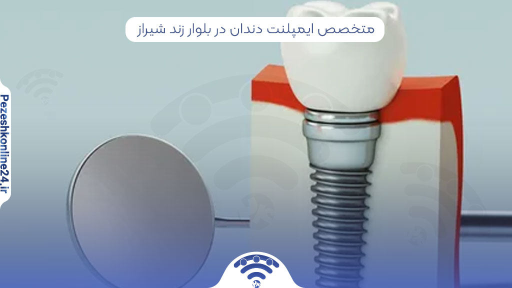 متخصص ایمپلنت دندان در بلوار زند شیراز