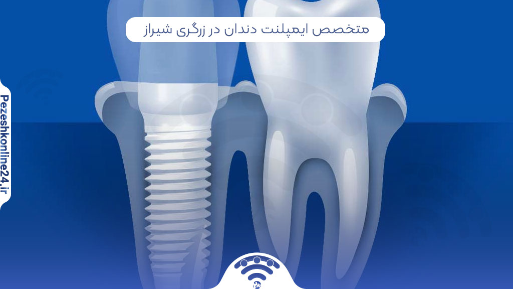 متخصص ایمپلنت دندان در زرگری شیراز