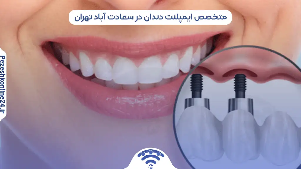 ایمپلنت دندان در سعادت آباد تهران