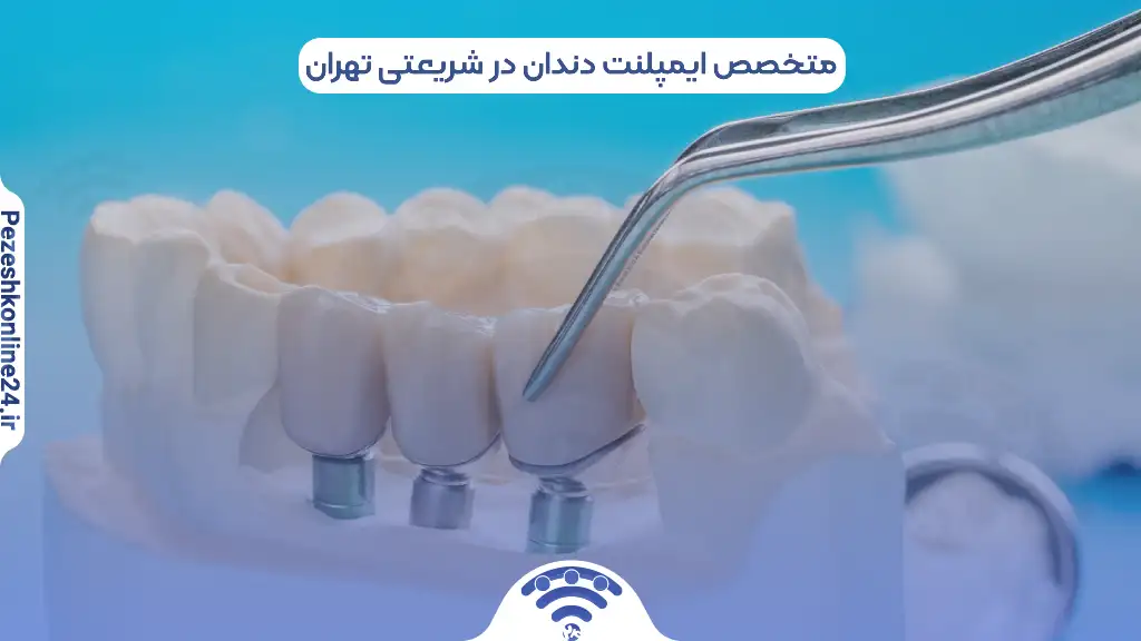 متخصص ایمپلنت دندان در شریعتی تهران