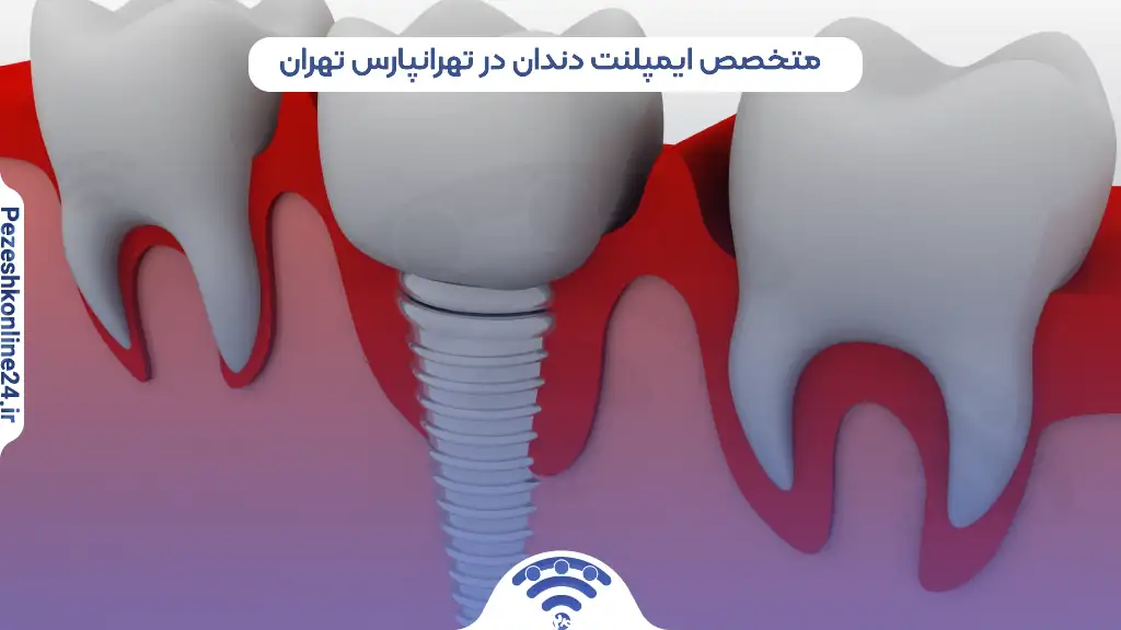 متخصص ایمپلنت دندان در تهرانپارس تهران