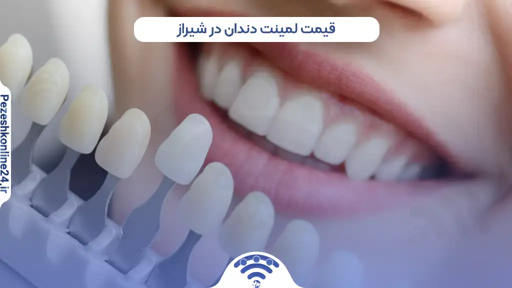 قیمت لمینت دندان در شیراز