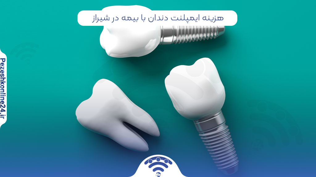 هزینه ایمپلنت دندان با بیمه در شیراز
