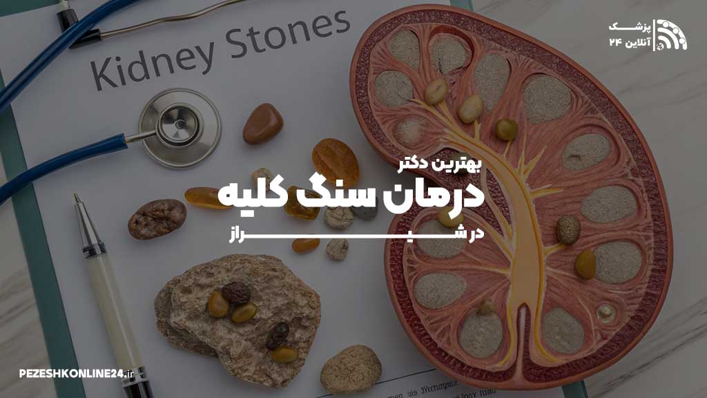 بهترین دکتر درمان سنگ کلیه در شیراز